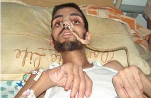 Two more Palestinians die in Gaza due to inability to travel for treatment