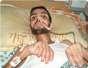 Two others Gazan patients die bringing to 65 the number of siege victims