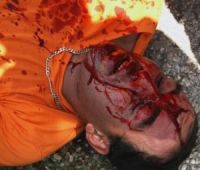 Israeli demonstrator badly injured in Bil’in demonstration