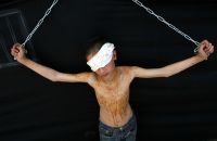 IOA using prisoners as medical guinea pigs